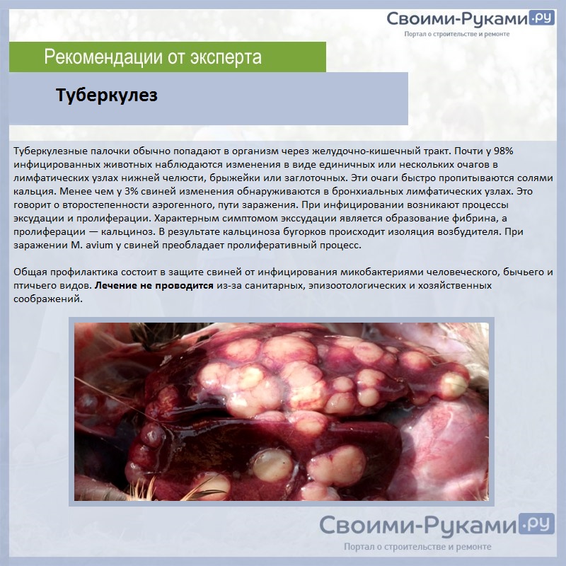 Туберкулез (tuberculosis)
